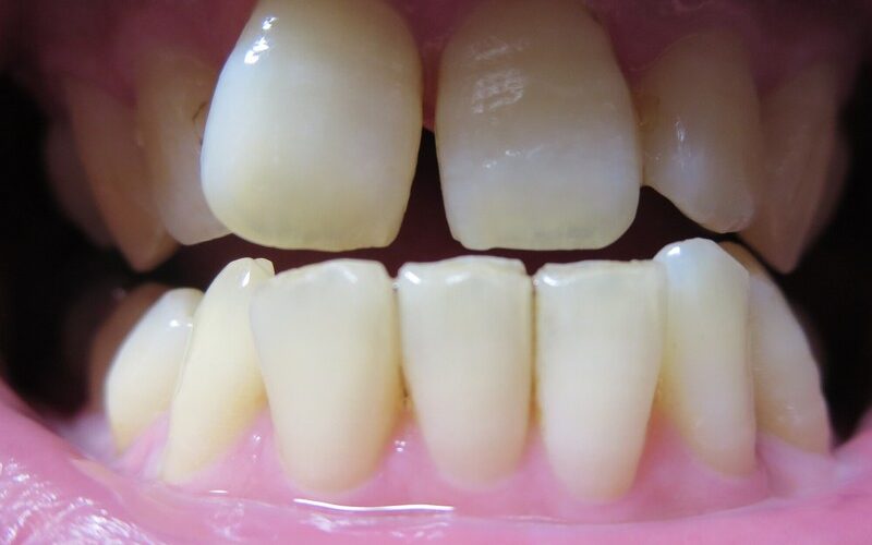 orthodontics_1