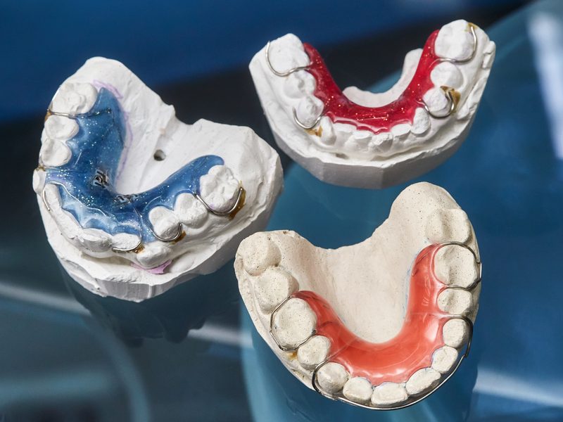 Colorful dental braces or retainers for teeth on black glass background, closeup