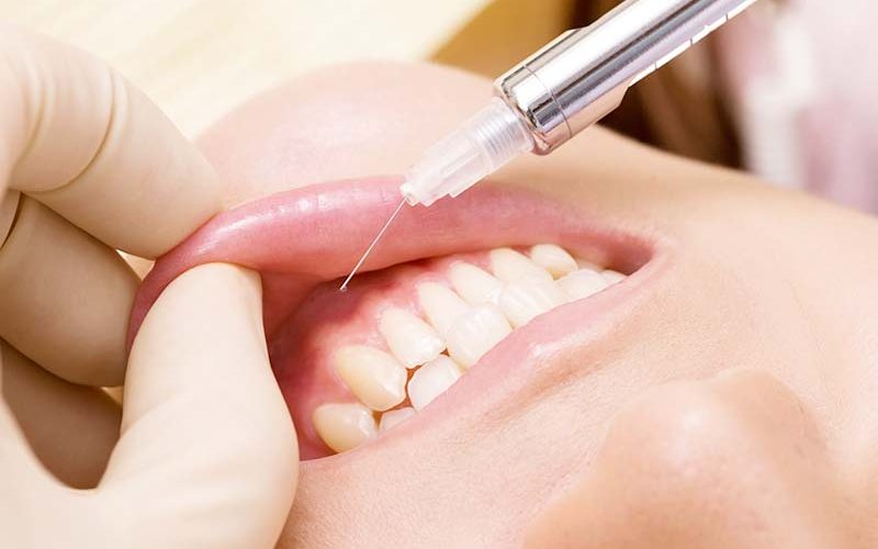 toothdecay1