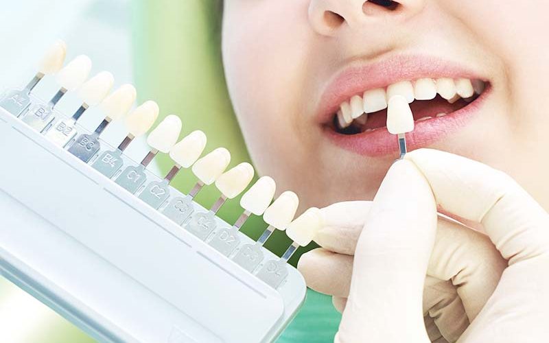 whitening1